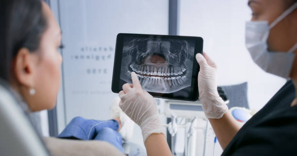 Licensed Root Canal Treatment service in Santa Clarita, CA - Smile Center Dentistry
